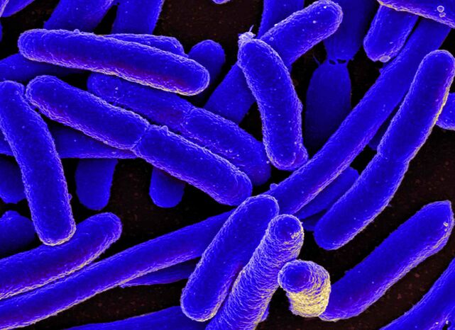 E. coli provoca con mayor frecuencia el desarrollo de cistitis en mujeres. 